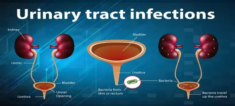common-causes-of-urinary-tract-infections